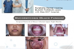black-fungus-treatment-2